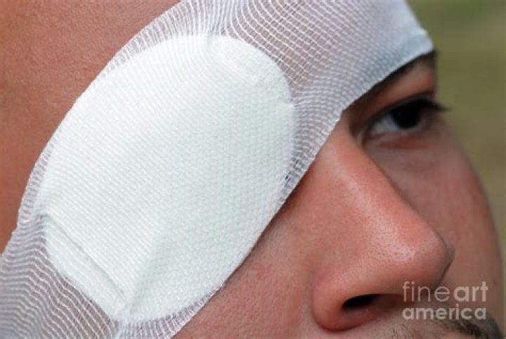 A Freak Accident Involved Brandy Contributing to This Immature Group Member's Wearing An Eye Patch |