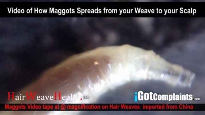 Maggots in Hair Extensions: A Shocking Health Hazard